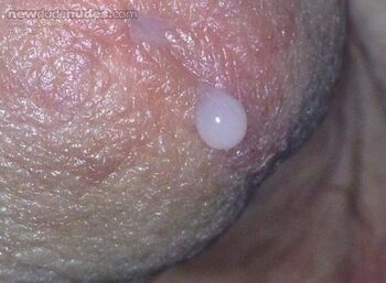 2frontteeth photo #14