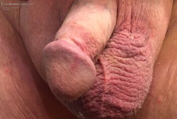 Dick