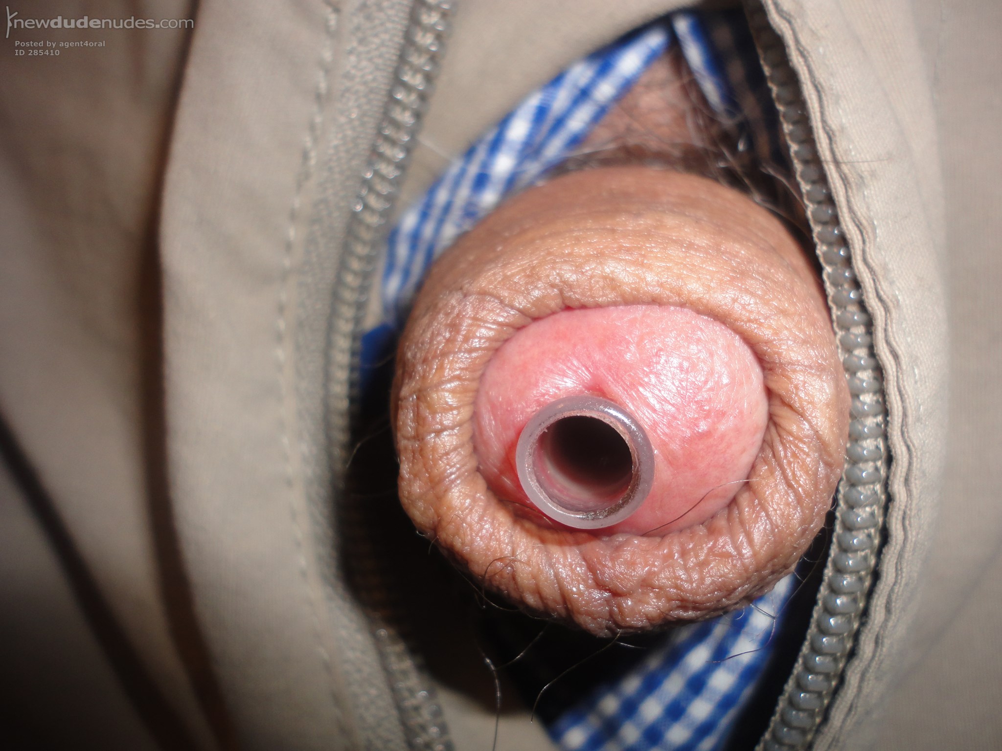 My Dick