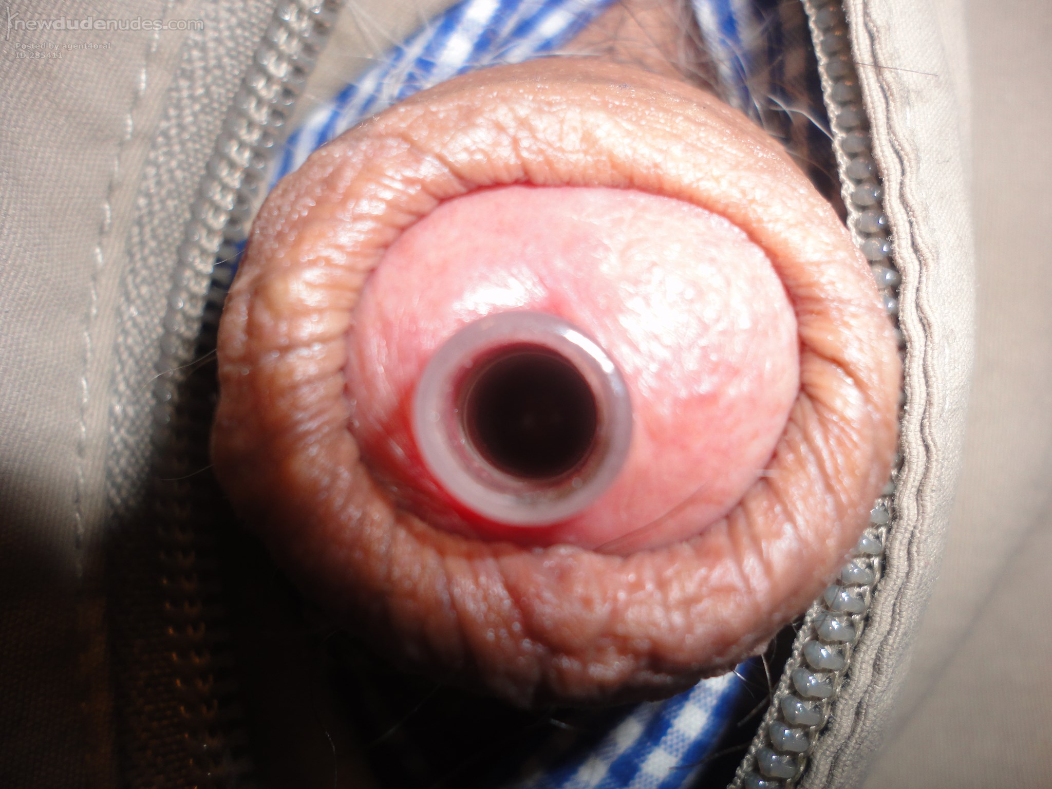 My Dick