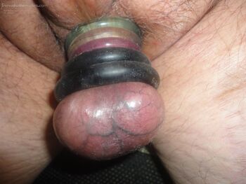 Stretched balls, 5 cock rings. Scrotum ready to bust.