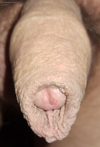 Foreskin lovers