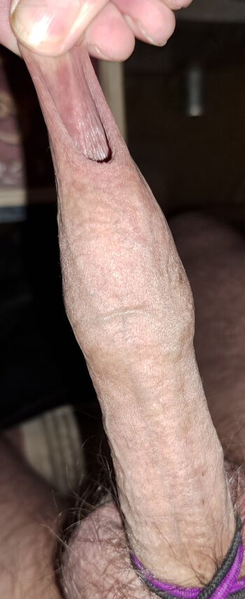 Foreskin lovers...