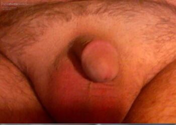 Grows in your mouth