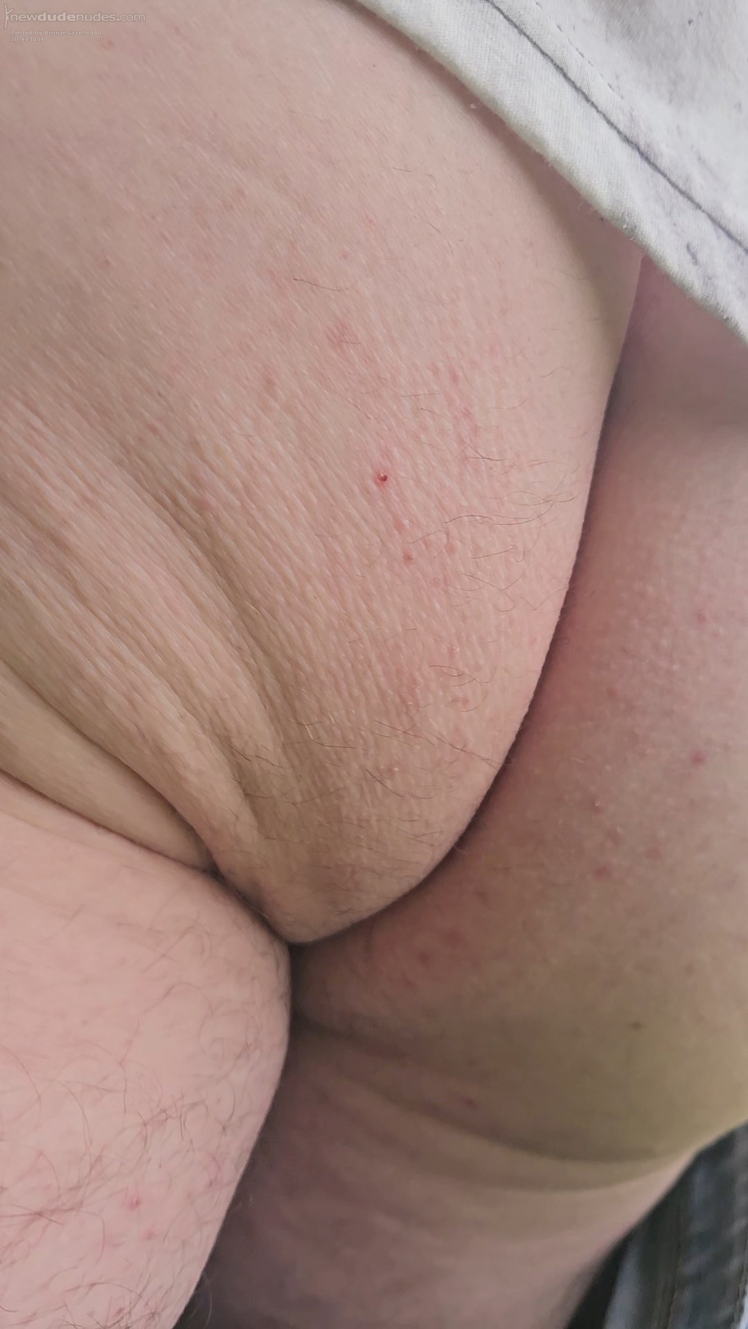 Bum